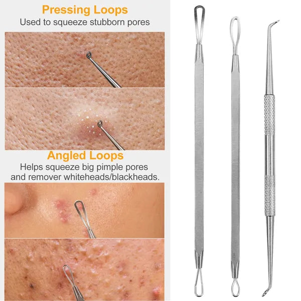 7-Piece Stainless Steel Blackhead Remover Kit — Pimple Comedone Acne Extractor Needle Tools