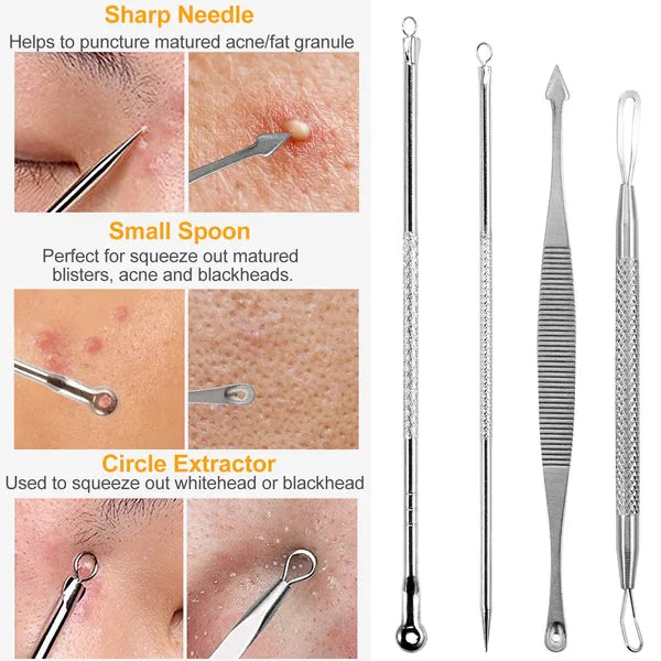 7-Piece Stainless Steel Blackhead Remover Kit — Pimple Comedone Acne Extractor Needle Tools